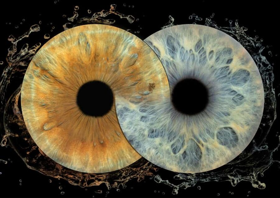 IRIS Photography (macro photo of your eye) - Key Things You’ll Notice Right Away
